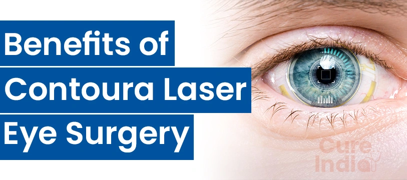 Benefits of Contoura Laser Eye Surgery